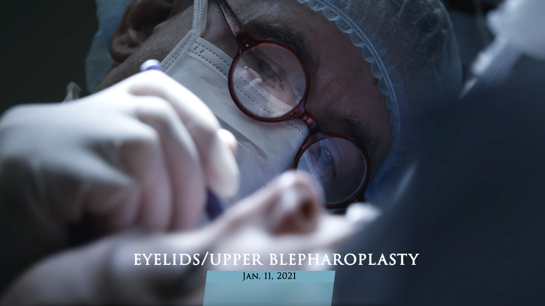 Upper Eyelid Surgery Video Cover